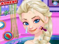 Jeu mobile Ice queen acne treatment