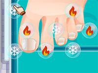 Jeu mobile Blonde sofia: ingrown toenail